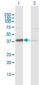 HDGF Antibody in Western Blot (WB)