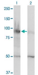 HELLS Antibody in Western Blot (WB)