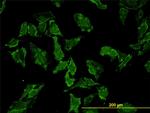 HFE Antibody in Immunocytochemistry (ICC/IF)