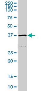 HFE Antibody in Western Blot (WB)