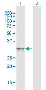 NRG1 Antibody in Western Blot (WB)