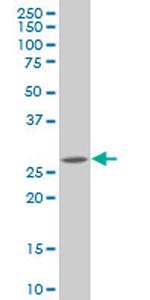 HHEX Antibody in Western Blot (WB)