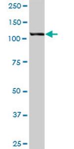 HIP1 Antibody in Western Blot (WB)