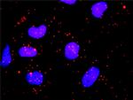 HIP1 Antibody in Proximity Ligation Assay (PLA) (PLA)