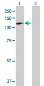 HIP1 Antibody in Western Blot (WB)