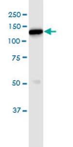 HK1 Antibody in Immunoprecipitation (IP)