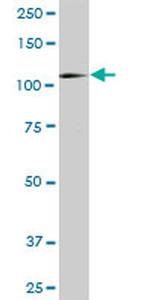 HK1 Antibody in Western Blot (WB)