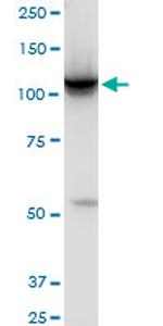 HK2 Antibody in Western Blot (WB)