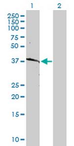 HLA-B Antibody in Western Blot (WB)