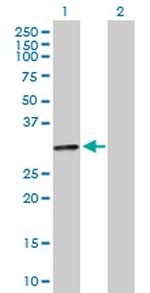 HLA-DOA Antibody in Western Blot (WB)