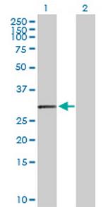 HLA-DOA Antibody in Western Blot (WB)