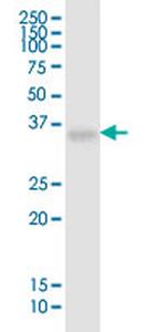 HLA-G Antibody in Western Blot (WB)