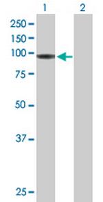 HLCS Antibody in Western Blot (WB)