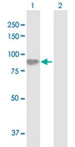 HLCS Antibody in Western Blot (WB)