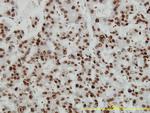 HMGB1 Antibody in Immunohistochemistry (Paraffin) (IHC (P))