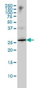 HMGB1 Antibody in Western Blot (WB)