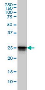 HMGB1 Antibody in Western Blot (WB)