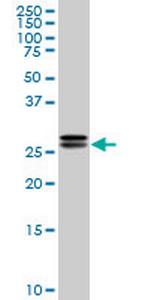 HMGB2 Antibody in Western Blot (WB)