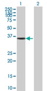 HMGCL Antibody in Western Blot (WB)