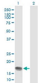 HMGA1 Antibody in Western Blot (WB)