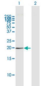 HMGA1 Antibody in Western Blot (WB)