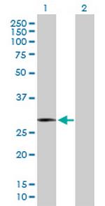 HMOX1 Antibody in Western Blot (WB)