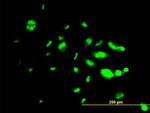 FOXA1 Antibody in Immunocytochemistry (ICC/IF)