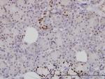 FOXA1 Antibody in Immunohistochemistry (Paraffin) (IHC (P))