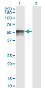 FOXA1 Antibody in Western Blot (WB)