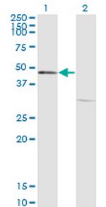 FOXA1 Antibody in Western Blot (WB)