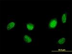 HNF4A Antibody in Immunocytochemistry (ICC/IF)