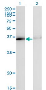 HNRPA1 Antibody in Western Blot (WB)