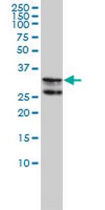 HNRPA2B1 Antibody in Western Blot (WB)