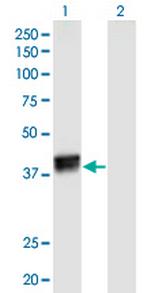 HNRNPC Antibody in Western Blot (WB)