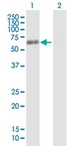 HNRNPK Antibody in Western Blot (WB)