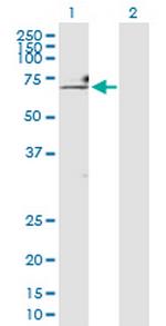 HNRNPK Antibody in Western Blot (WB)