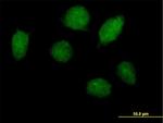 HOXA1 Antibody in Immunocytochemistry (ICC/IF)