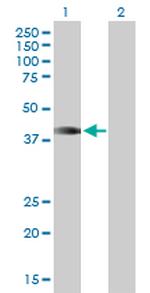 HOXA1 Antibody in Western Blot (WB)