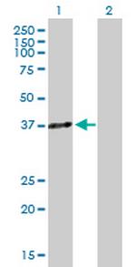 HOXA5 Antibody in Western Blot (WB)