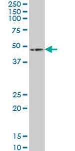 HOXA5 Antibody in Western Blot (WB)