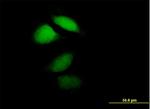 HPCA Antibody in Immunocytochemistry (ICC/IF)