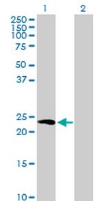 HPCA Antibody in Western Blot (WB)