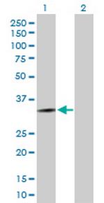 HOXD13 Antibody in Western Blot (WB)