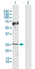 HPGD Antibody in Western Blot (WB)