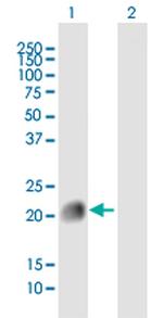 HRAS Antibody in Western Blot (WB)