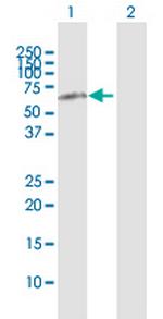 HRG Antibody in Western Blot (WB)