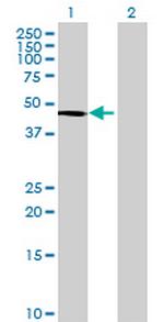 HRMT1L1 Antibody in Western Blot (WB)