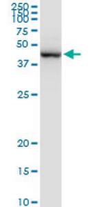 PRMT2 Antibody in Western Blot (WB)