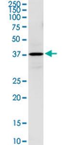 HSD3B1 Antibody in Western Blot (WB)