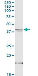 HSD3B1 Antibody in Western Blot (WB)